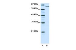 KDM2A/FBXL11 Antibody, Novus Biologicals 100 &mu;L | Buy Online | Novus Biologicals | Fisher Scientific